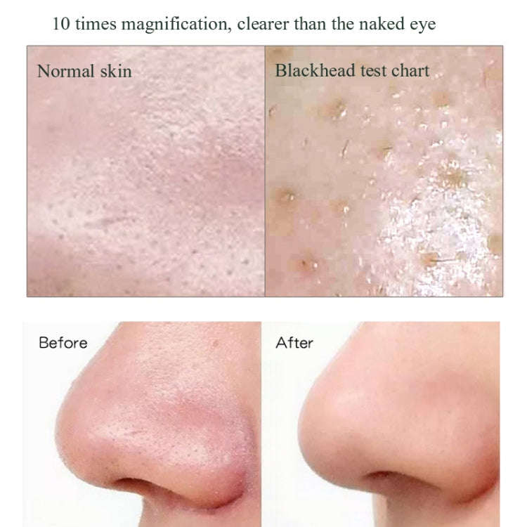 Blackhead Electric Pore Removal Machine Clean Facial Equipment,Style: Visual Model