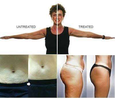 NU SKIN Ageloc Galvanic Body Device Kit