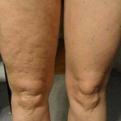 NU SKIN Ageloc Galvanic Body Device Kit