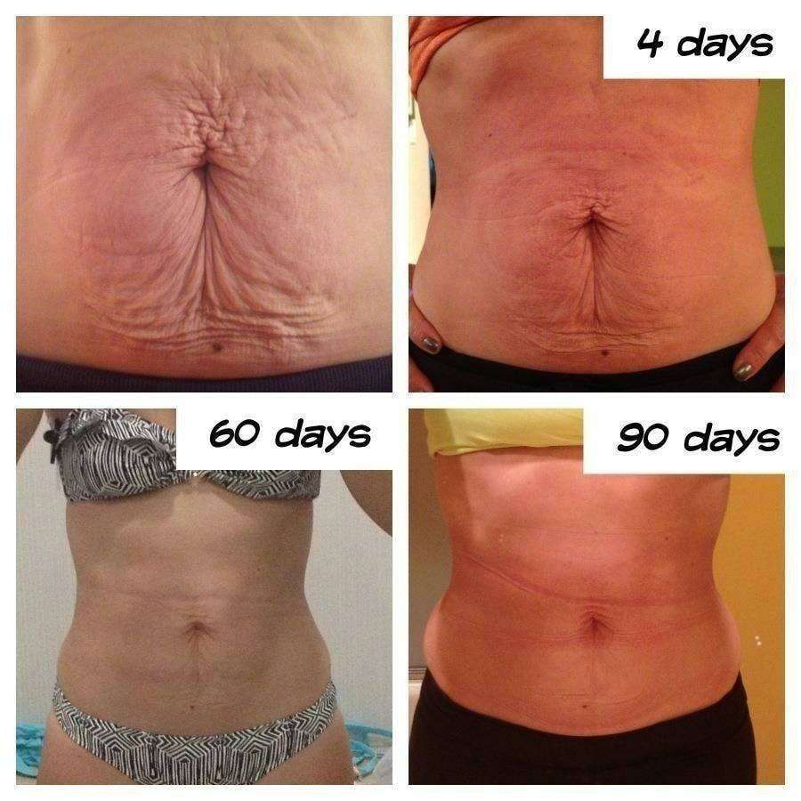 NU SKIN Ageloc Galvanic Body Device Kit