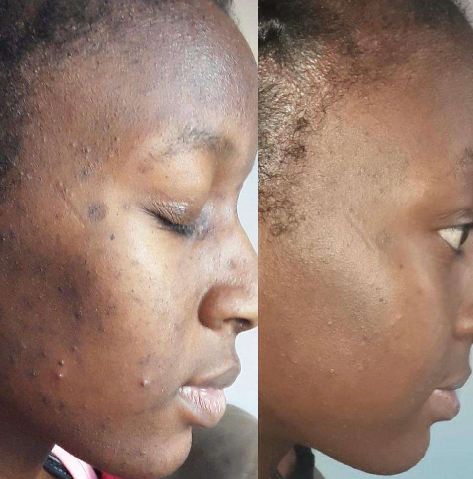 EPOCH Soap-Free Polishing Bar