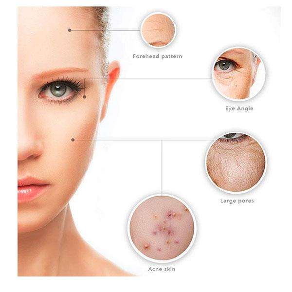 6-in-1 Derma Roller Set - Black