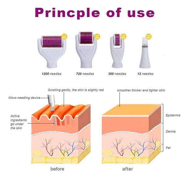 6-in-1 Derma Roller Set - Black