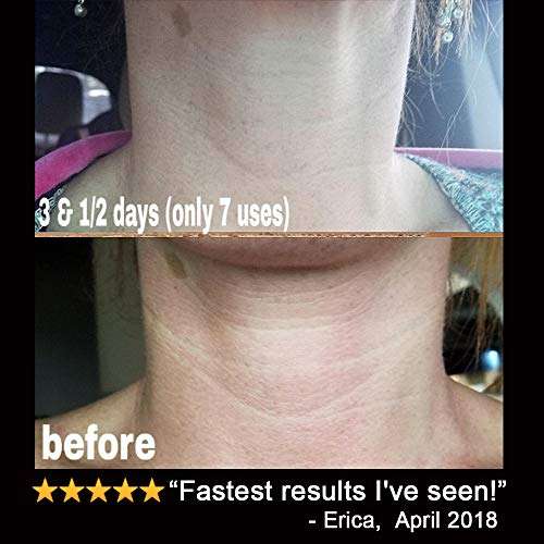 LilyAna Naturals Retinol Cream Moisturizer 1.7 Oz