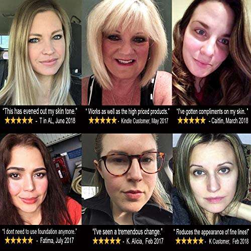 LilyAna Naturals Retinol Cream Moisturizer 1.7 Oz