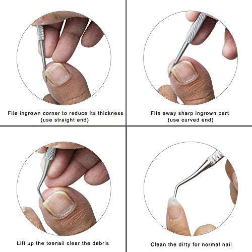 ZIZZON Ingrown Toenail File and Lifter Double Sided Professional Surgical Grade