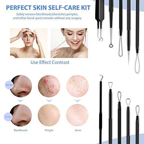 Pimple Popper Tool, Aooeou Stainless Steel Blackhead Remover Acne Tool 10 PCS Kit with a Metal Case