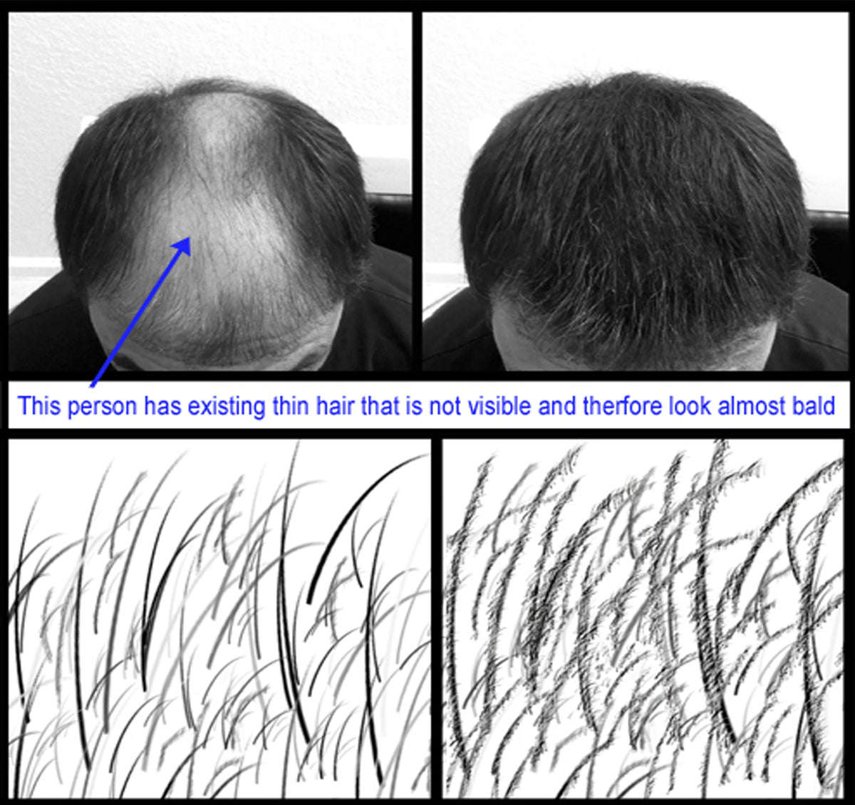 Hair Building Fibers DARK BROWN Refill kit By Samson Large 25 Grams Made in USA Hair Concealer