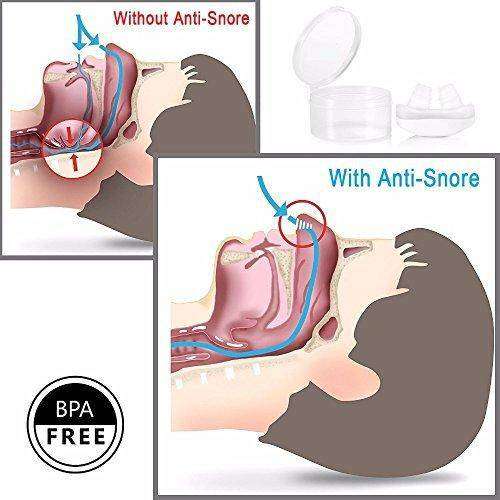 2 in 1 Anti Snoring and Air Purifier