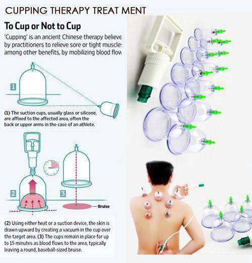Chinesse Cupping Vacuum 12pcs