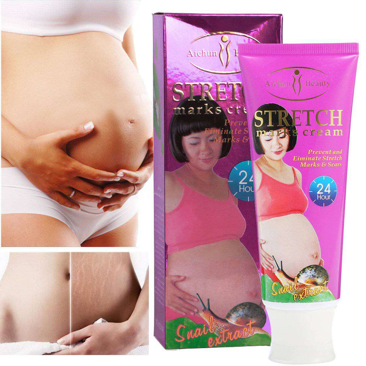 Snail Stretch Marks Cream
