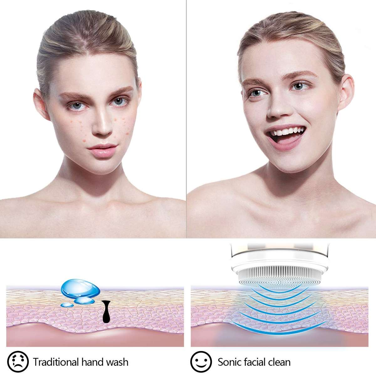 Sonic Facial Cleansing Brush
