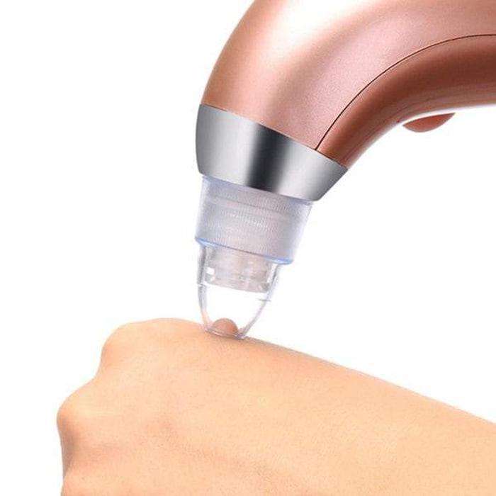 Blackhead & Acne Vacuum Pore Cleaner