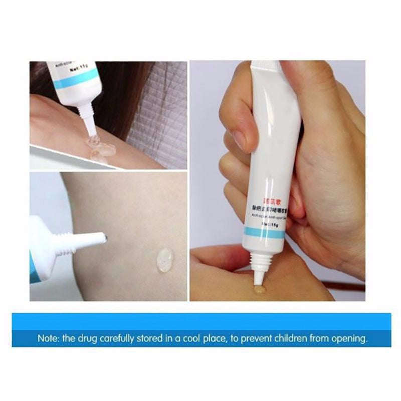 Scar Removal Cream