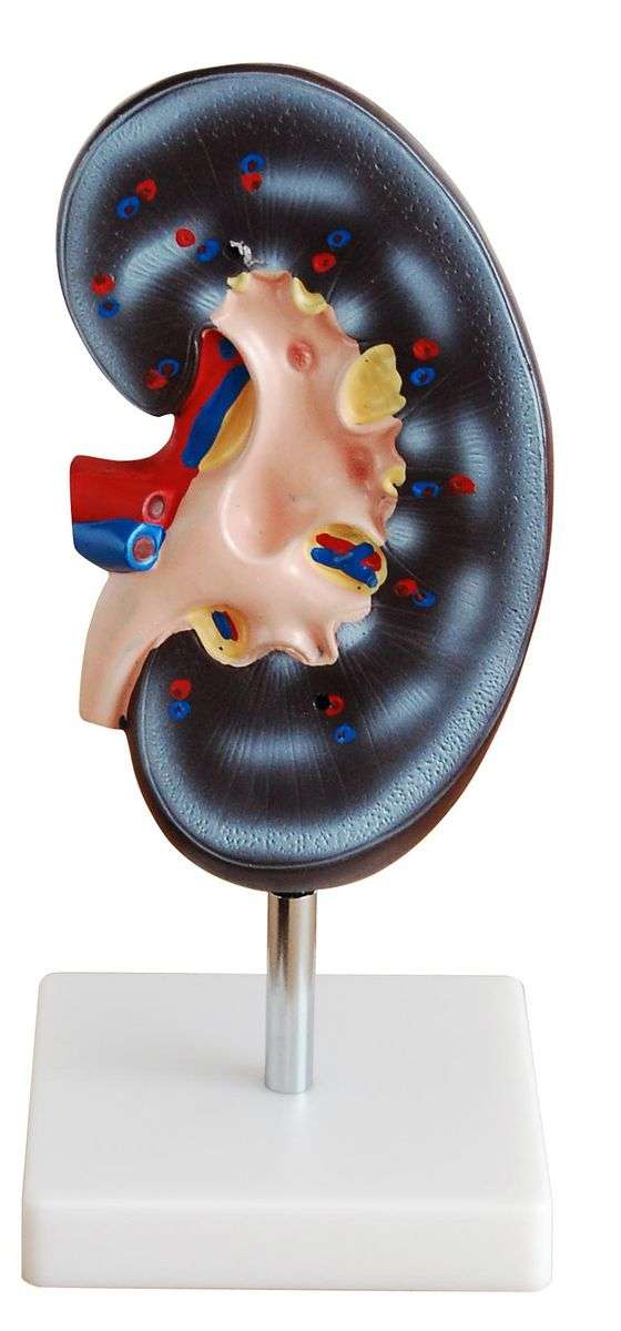 Anatomical Kidney Model (2 parts)