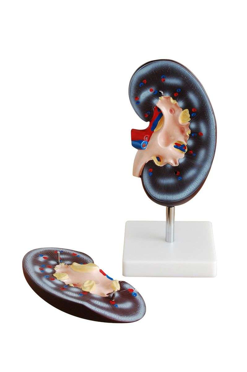 Anatomical Kidney Model (2 parts)