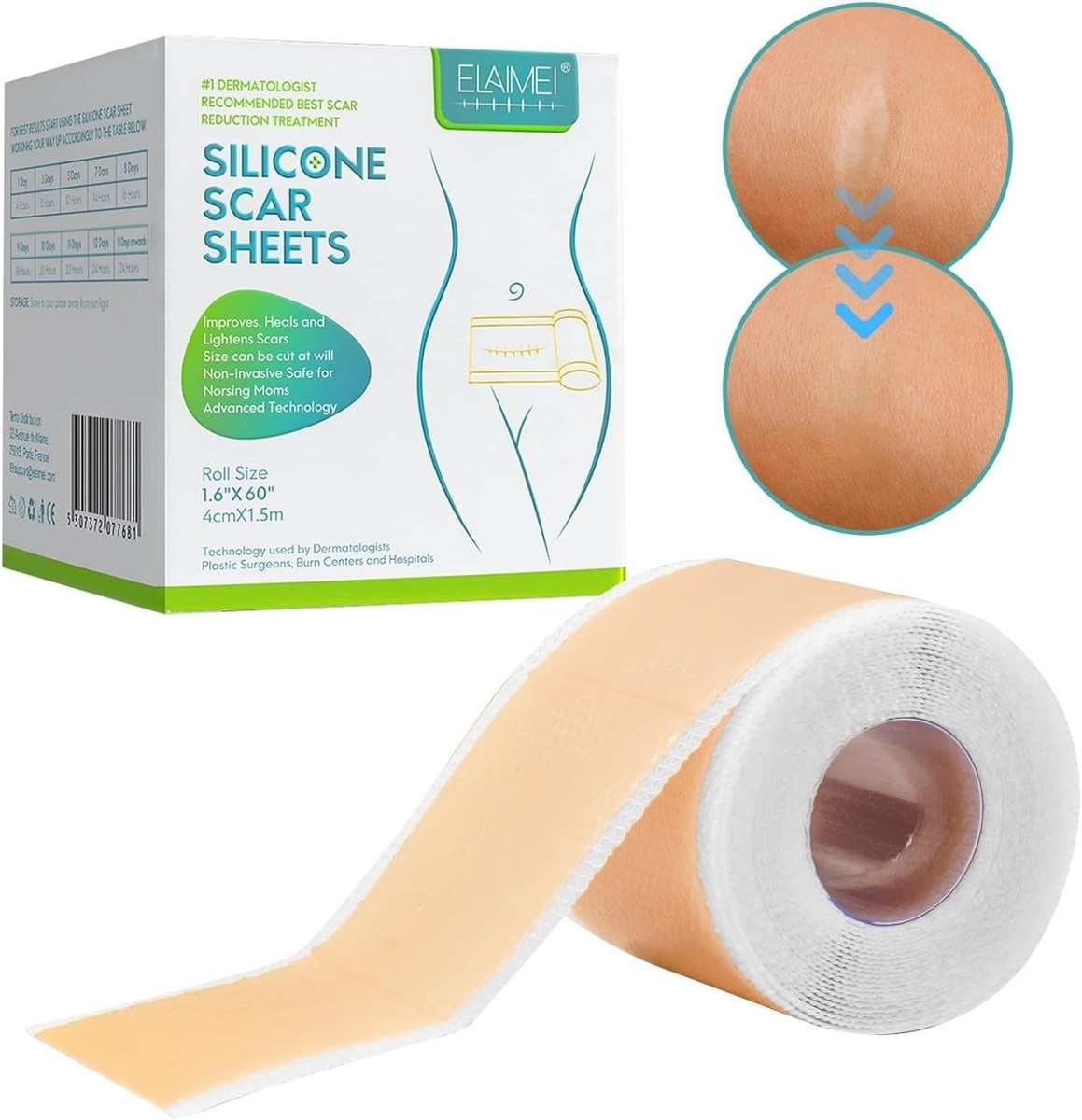 Silicone Scar Sheets