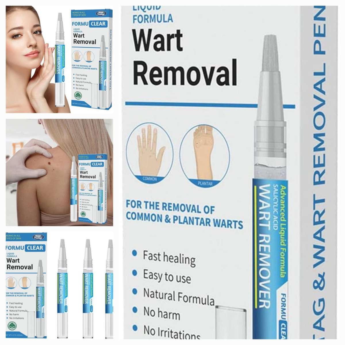 Wart Remover Pen Skin Tag Mole Remover