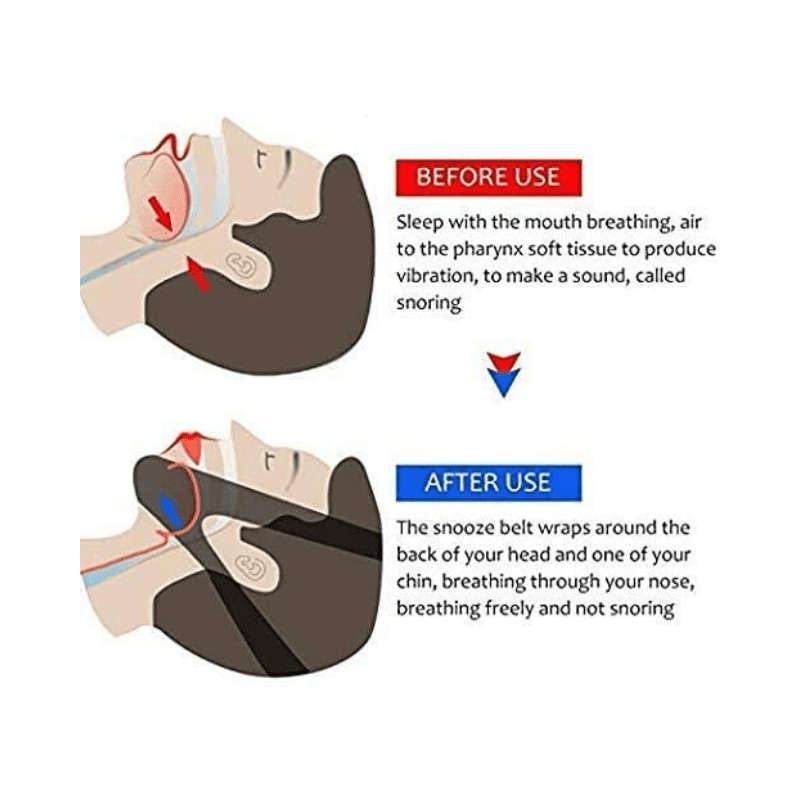 Anti Snoring chin strap for men & women - Adjustable stop snoring solution - Snore stopper chin s...