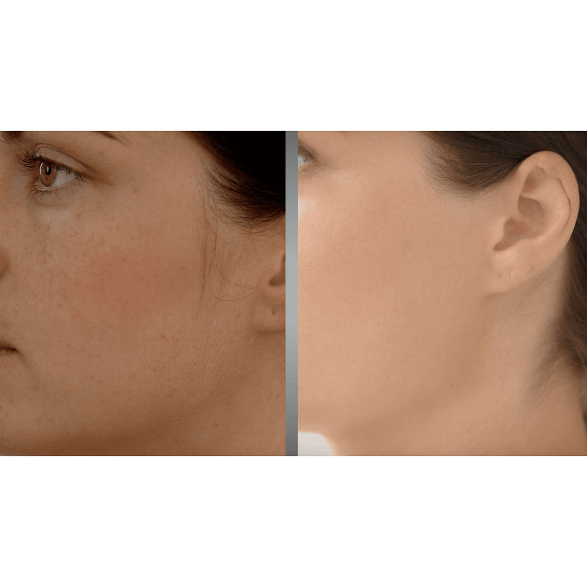 NuBrilliance Ultimate Painless Hair Remover