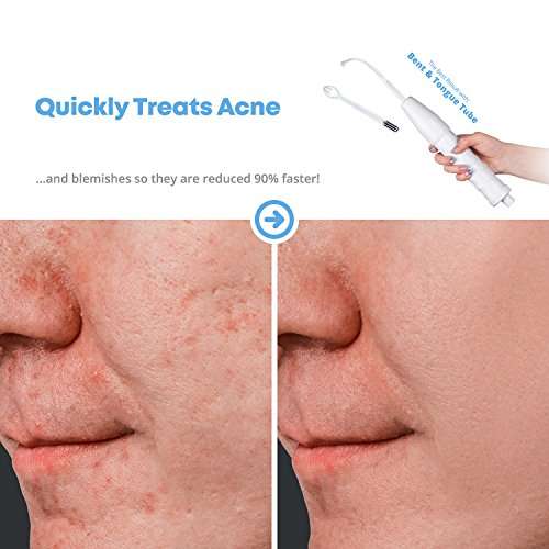 NuDerma Skin Therapy Wand - Portable Handheld High Frequency Skin Therapy Machine - Acne..