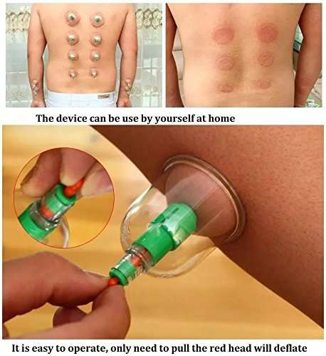 12PCS Chinese Vacuum Cupping Kit Pull Out a Vacuum Apparatus Therapy Set