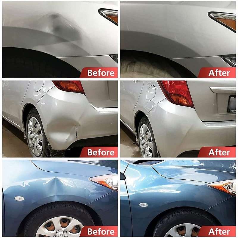 Car Damage-Free Paint Dent Repair Tool Set(MPT-N0147)