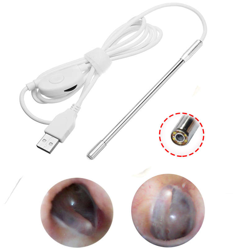 4.9mm Lens Medical USB Ear Nose Endoscope Borescope Inspection Otoscope Endoscope Camera for OTG An