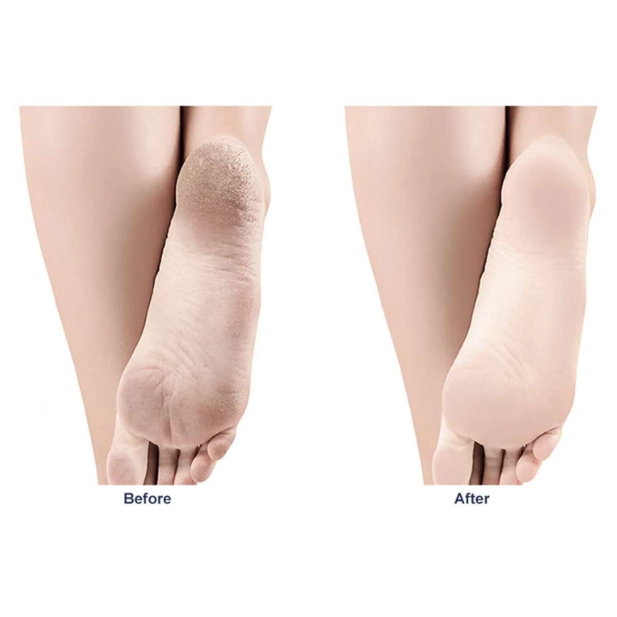 Foot Grinding Artifact