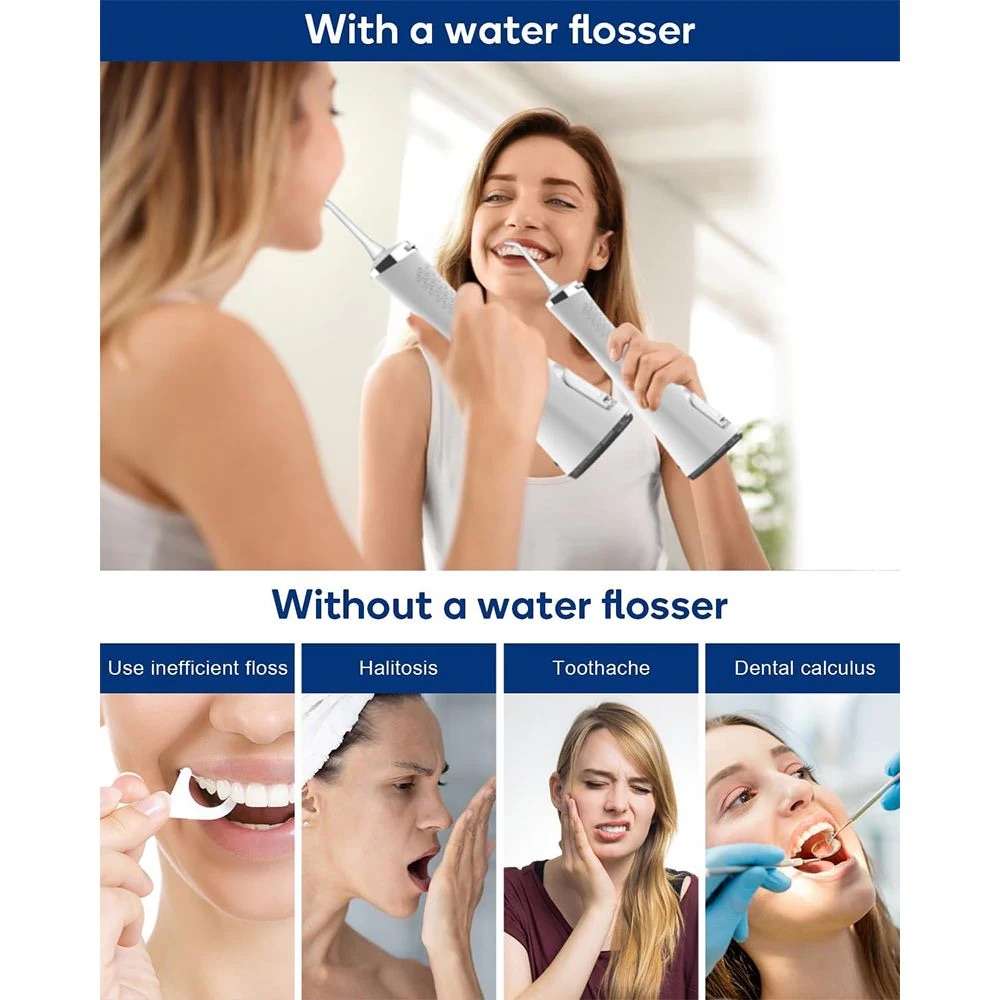 Lumine Portable Water Flosser - 5 Modes, USB Rechargeable, IPX7 Waterproof