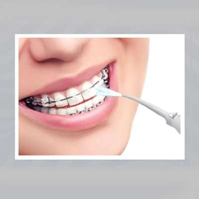 Igia Pressure Water Flosser