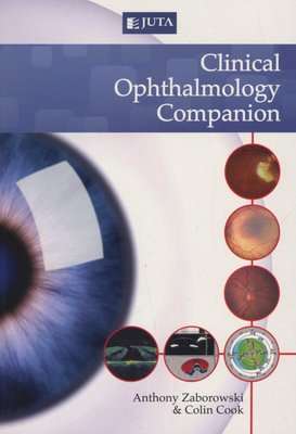 Clinical ophthalmology companion (Paperback)