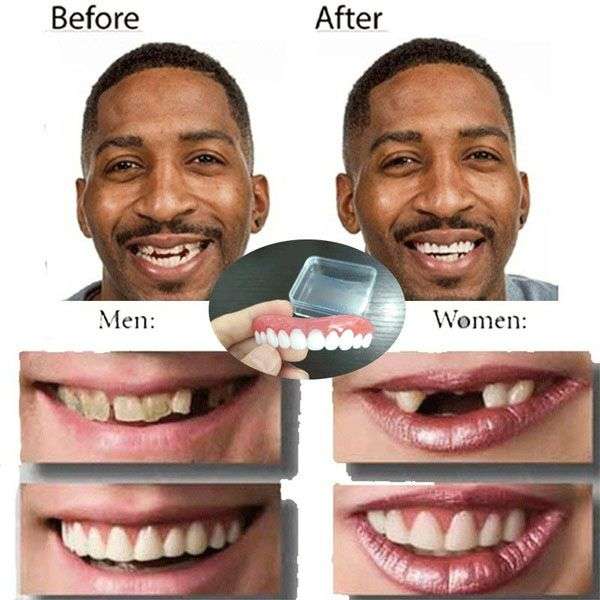 Perfect Smile - Incredible and Instant Reusable and Removable Veneers