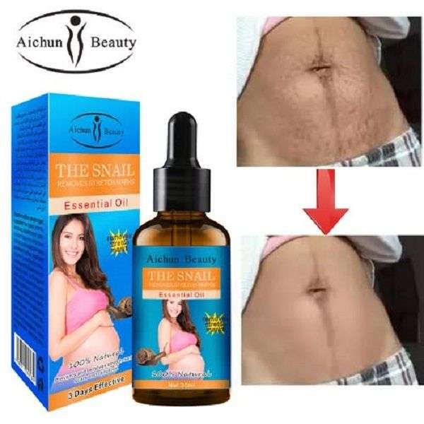 Snail Extract Stretch Mark, Cellulite, Scar Remover Essential Oil 30ml