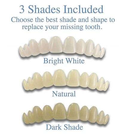 Cut and Use Denture Teeth Repair Kit with Filling Glue