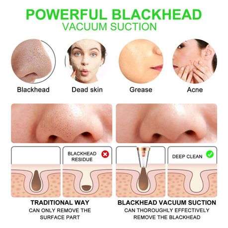 Andowl Blackhead Suction Instrument Q-M301