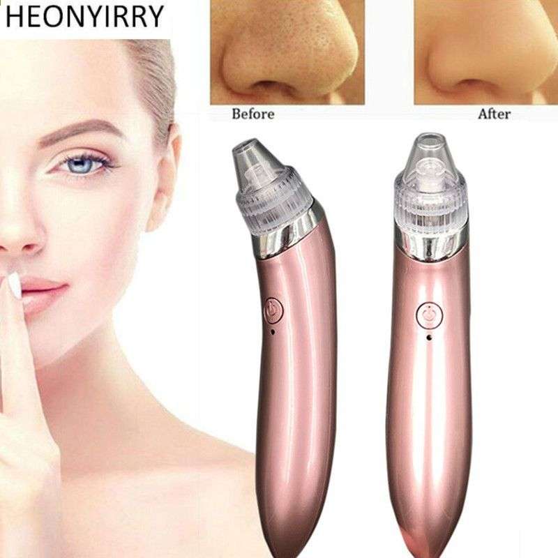 Vacuum Blackhead Suction Tool Pore Cleanser - Pink (USES BATTERIES)(DISPLAY ITEM)