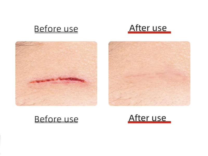 Red Light Therapy Panel (300W)