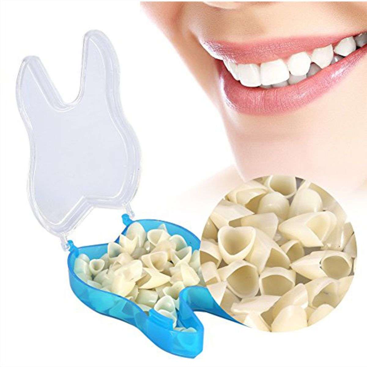 Temporary crowns, Teeth veneers, Anterior for front teeth