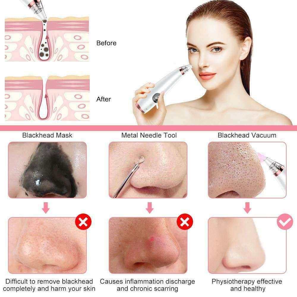 Multi Functional Cleaning Remove Black Head Device