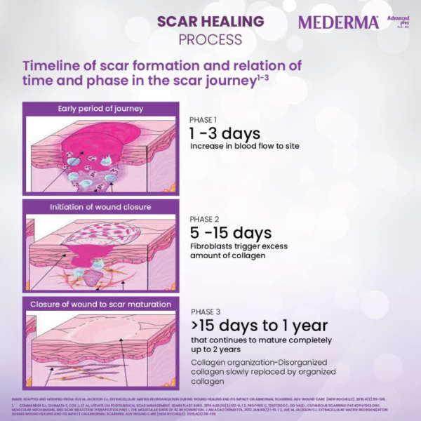 Mederma Advance Plus Scar Gel  Dermatologist-Recommended Scar Treatment
