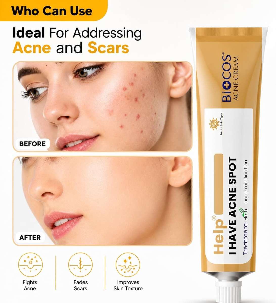 Biocos Acne Cream  Blemish Support Cream