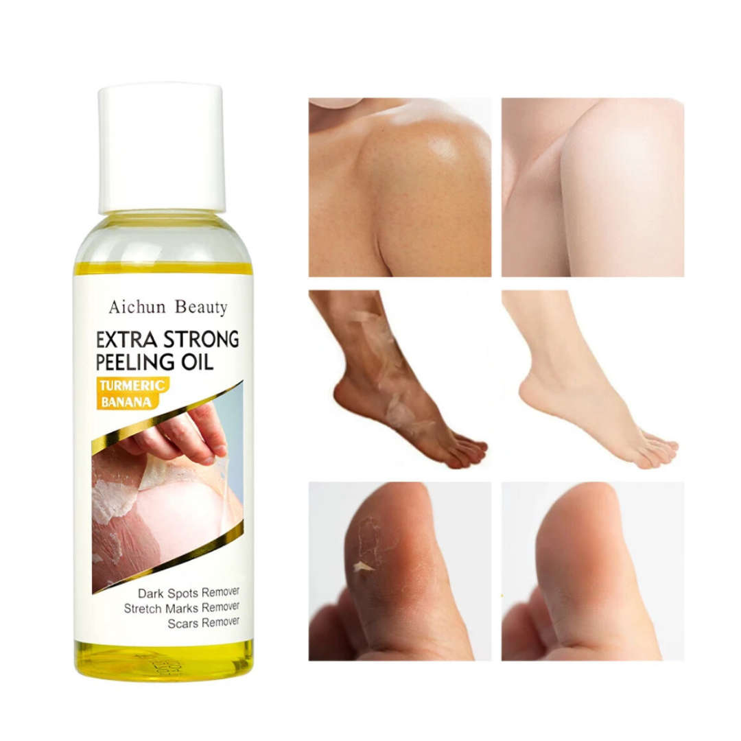 Aichun Beauty - Extra Strong Peeling Oil