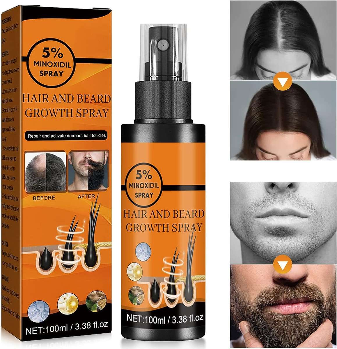 Hair & Beard Growth Spray 100ml With 5% Minoxidil