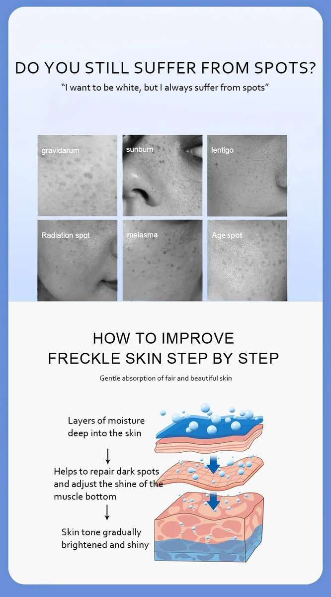 Tree Doctor Dark Spot Removal Cream Set