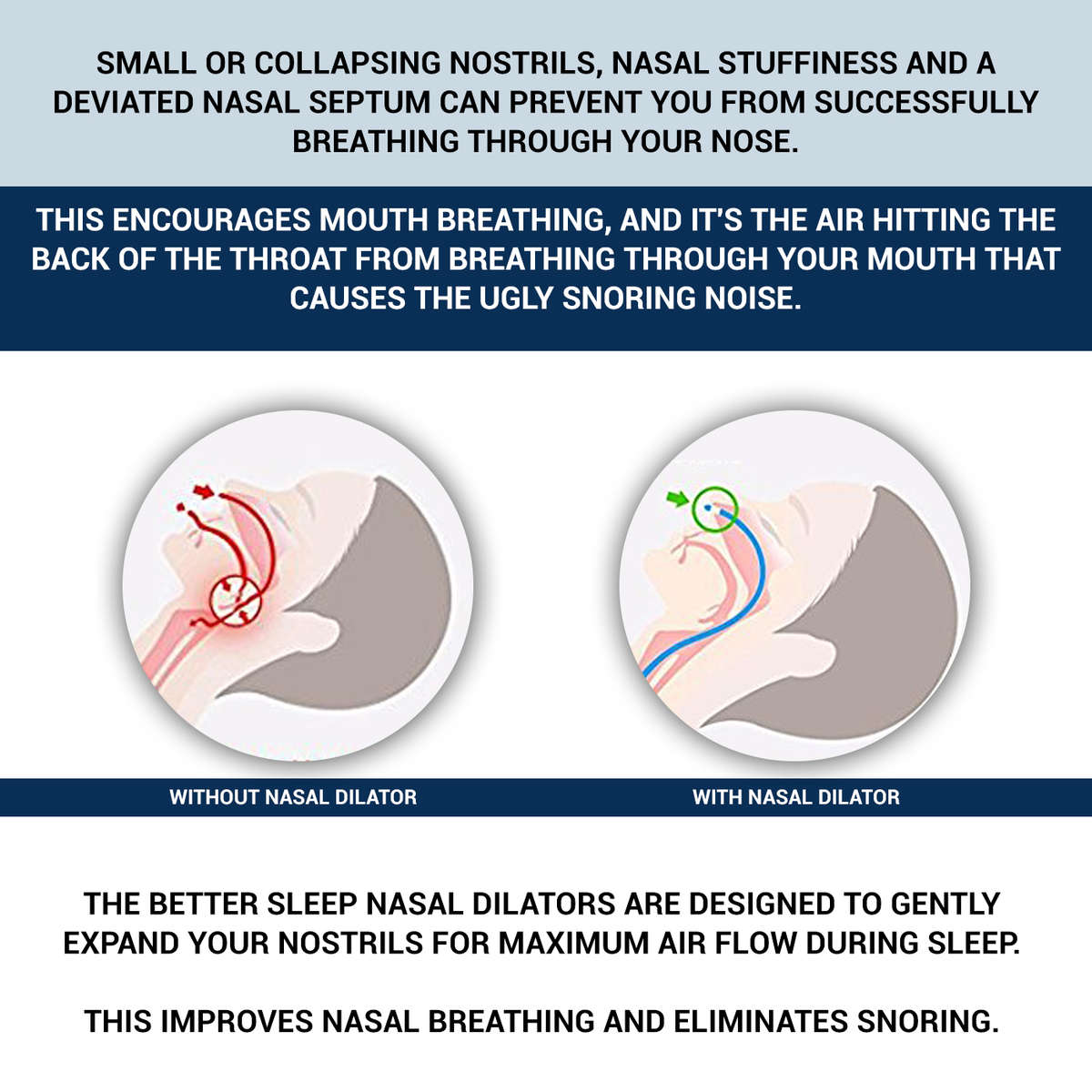 BetterSleep Anti-Snore Nasal Dilators