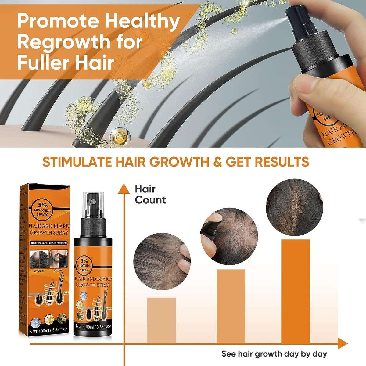 Hair & Beard Growth Spray 100ml With 5% Minoxidil