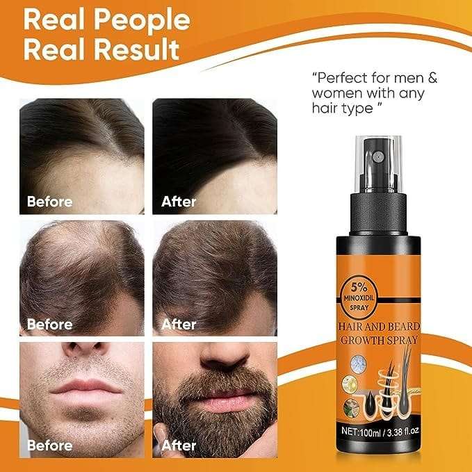 Hair & Beard Growth Spray 100ml With 5% Minoxidil