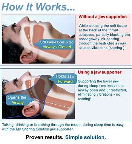 Snoring Solution - Anti Snoring Chin Strap - Supports Stop or reduces Snoring - Sleep Aid Device