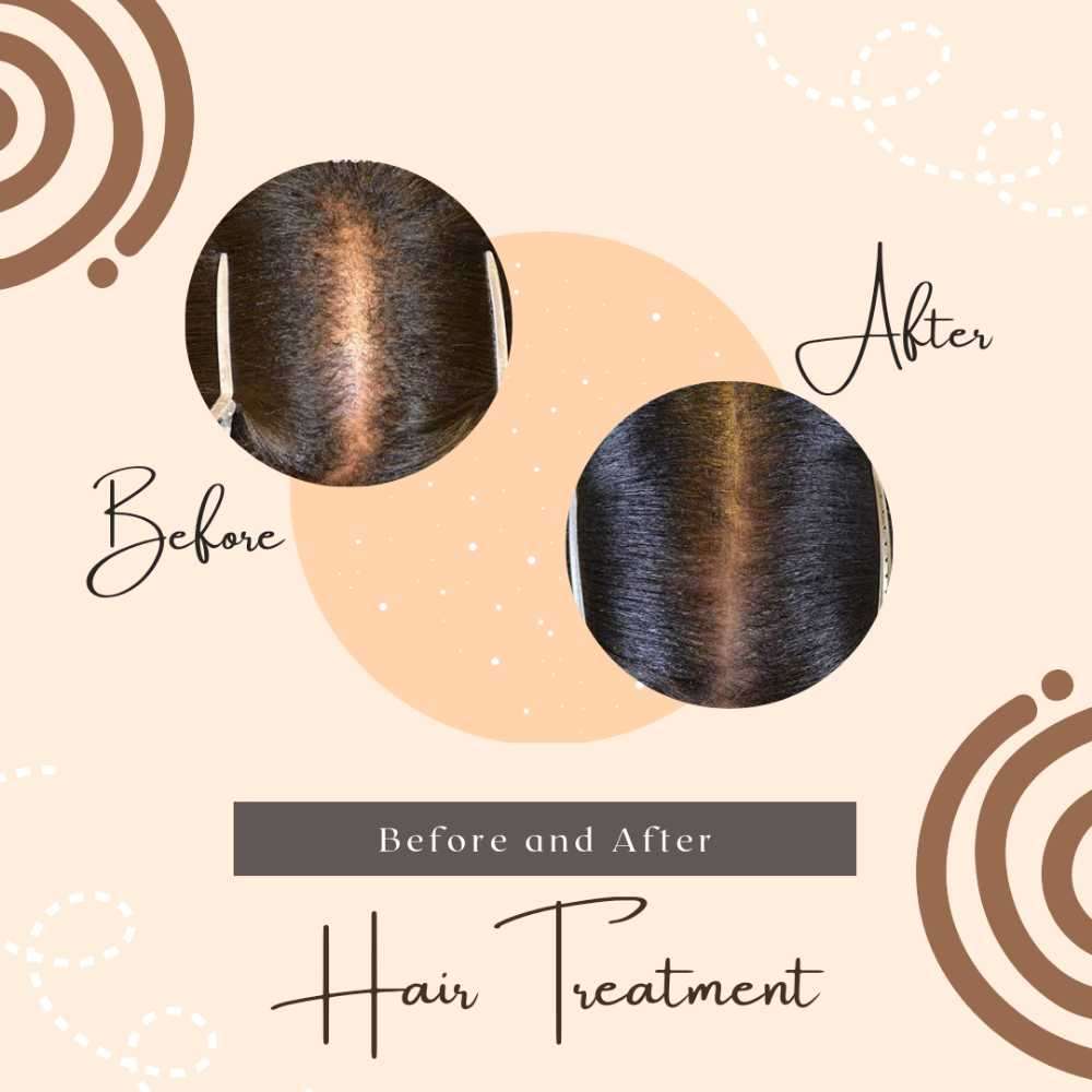 Cannabis (Dagga) Hair Growth Oil - 20 bottles